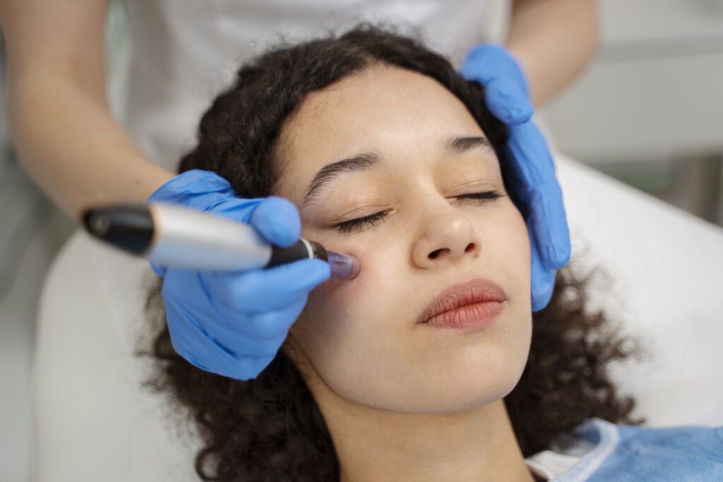 Microneedling for Acne Scars (and Beyond): What Patients Need to Know